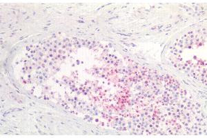 Detection of TAT1 in Human Testis Tissue using Polyclonal Antibody to Testis Anion Transporter 1 (TAT1) (SLC26A8 antibody  (AA 664-970))