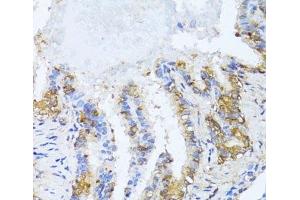 NAT2 antibody