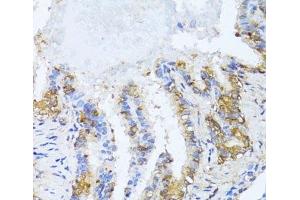 Immunohistochemistry of paraffin-embedded Rat lung using NAT2 Polyclonal Antibody at dilution of 1:100 (40x lens). (NAT2 antibody)