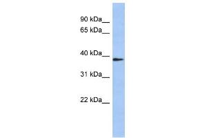 Western Blotting (WB) image for anti-Wingless-Type MMTV Integration Site Family, Member 10B (WNT10B) (Middle Region) antibody (ABIN2776702)