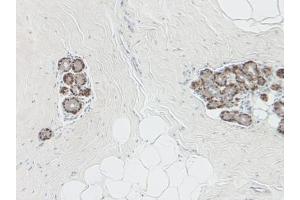 Immunohistochemistry (Paraffin-embedded Sections) (IHC (p)) image for anti-serpin Peptidase Inhibitor, Clade B (Ovalbumin), Member 5 (SERPINB5) antibody (ABIN487960)