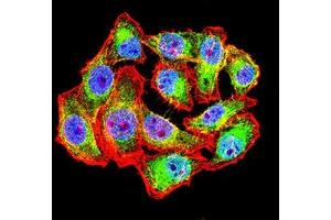 Immunofluorescence analysis of Hela cells using WT1 mouse mAb (green). (WT1 antibody  (AA 1-181))