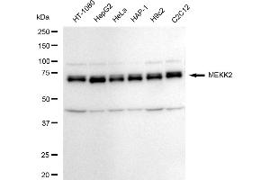 Western blotting analysis using MEKK2 antibody (ABIN7799469).