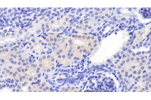 Detection of Cys-C in Porcine Kidney Tissue using Polyclonal Antibody to Cystatin C (Cys-C) (CST3 antibody  (AA 42-127))