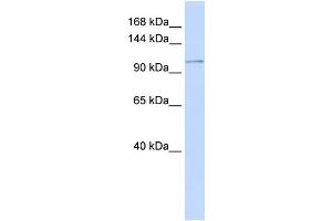 WB Suggested Anti-ATP2B3 Antibody Titration:  0.