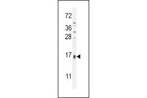 TCL6 Antibody (C-term) (ABIN654803 and ABIN2844478) western blot analysis in HL-60 cell line lysates (35 μg/lane). (TCL6 antibody  (C-Term))