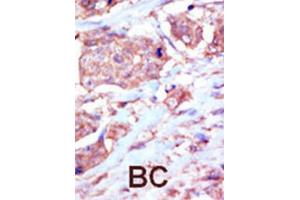 Immunohistochemistry (IHC) image for anti-EPH Receptor B6 (EPHB6) antibody (ABIN3003353)