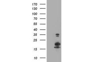HEK293T cells were transfected with the pCMV6-ENTRY control (Left lane) or pCMV6-ENTRY LSM1 (Right lane) cDNA for 48 hrs and lysed. (LSM1 antibody)