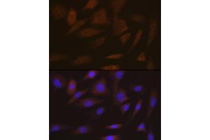 Immunofluorescence (IF) image for anti-Structural Maintenance of Chromosomes 4 (SMC4) antibody (ABIN7270618)