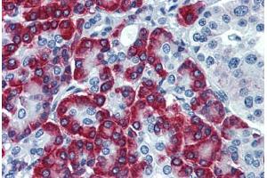 Human Pancreas: Formalin-Fixed, Paraffin-Embedded (FFPE) (SSR1 antibody  (AA 33-287))