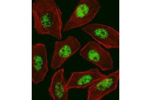 Immunofluorescence (IF) image for anti-Regulatory Factor X, 1 (Influences HLA Class II Expression) (RFX1) antibody (ABIN2998977) (RFX1 antibody)