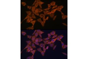 Immunofluorescence analysis of NIH-3T3 cells using Syntaxin 4 Rabbit mAb (ABIN7270687) at dilution of 1:100 (40x lens). (Syntaxin 4 antibody)