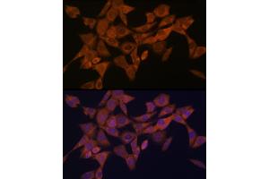 Immunofluorescence analysis of NIH-3T3 cells using Syntaxin 4 Rabbit mAb (ABIN7270687) at dilution of 1:100 (40x lens). (Syntaxin 4 antibody)
