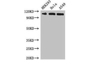 Western Blot Positive WB detected in: HEK293 whole cell lysate, Hela whole cell lysate, A549 whole cell lysate All lanes: IPO13 antibody at 3 μg/mL Secondary Goat polyclonal to rabbit IgG at 1/50000 dilution Predicted band size: 109 kDa Observed band size: 109 kDa (IPO13 antibody  (AA 501-700))