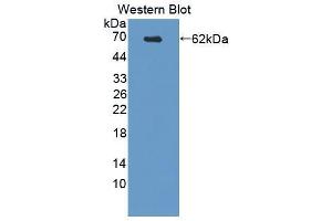 Western blot analysis of the recombinant protein. (PDX1 antibody  (AA 1-284))