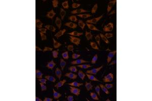 Immunofluorescence analysis of L929 cells using EIF5B antibody (ABIN7267052) at dilution of 1:100. (EIF5B antibody  (AA 1-273))
