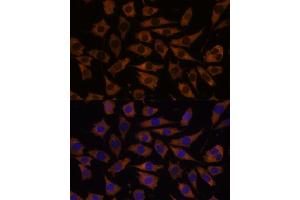 EIF5B antibody  (AA 1-273)