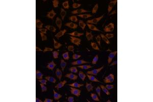 Immunofluorescence analysis of L929 cells using EIF5B antibody (ABIN7267052) at dilution of 1:100. (EIF5B antibody  (AA 1-273))