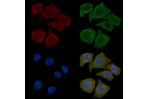 ABIN6260240 and ABIN6269134 staining Hela cells(45 min of heat-shock) by IF/ICC.