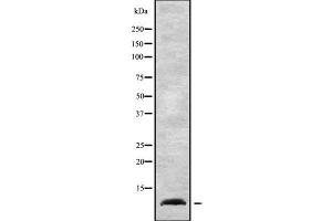 Western blot analysis NDUFA1 using K562 whole cell lysates (NDUFA1 antibody  (Internal Region))