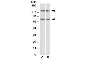 Western blot testing of Jurkat [A] and HeLa [B] lysates with CAPRIN1 antibody at 0. (Caprin-1 antibody)