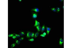 Immunofluorescence staining of Hela cells with ABIN7153319 at 1:66, counter-stained with DAPI. (G Protein-Coupled Receptor 12 antibody  (AA 1-48))