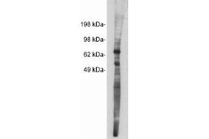 Image no. 1 for anti-Netrin 1 (NTN1) antibody (ABIN265184) (Netrin 1 antibody)