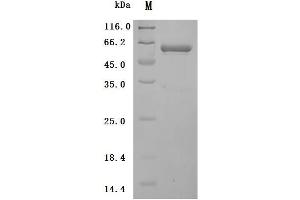 Cathepsin D (CTSD) (AA 21-412), (full length) (Active) protein (His tag)