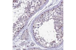 Immunohistochemical staining of human testis with DNTTIP2 polyclonal antibody  shows moderate nuclear and cytoplasmic positivity in subsets of cells in seminiferus ducts. (DNTTIP2 antibody)