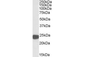 ABIN308466 (0. (Peroxiredoxin 1 antibody  (Internal Region))