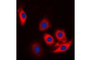 Immunofluorescent analysis of c-CBL (pY774) staining in Jurkat cells. (CBL antibody  (C-Term, pTyr774))