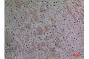 Immunohistochemistry (IHC) analysis of paraffin-embedded Mouse Brain, antibody was diluted at 1:100. (CCL26 antibody  (Internal Region))