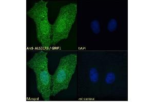 ABIN184943 Immunofluorescence analysis of paraformaldehyde fixed U2OS cells, permeabilized with 0. (TRAK2 antibody  (C-Term))