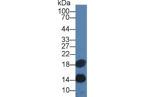 Detection of SAA in Human Serum using Monoclonal Antibody to Serum Amyloid A (SAA) (SAA antibody  (AA 19-122))