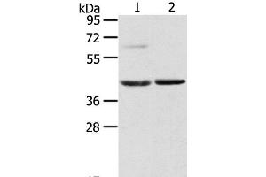 Western Blot analysis of Mouse brain and liver tissue using HIF1AN Polyclonal Antibody at dilution of 1:200 (HIF1AN antibody)