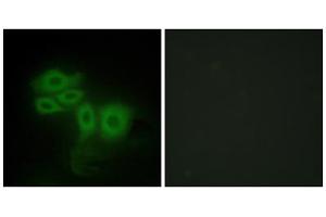 Immunofluorescence analysis of HepG2 cells, using SLK antibody. (SLK antibody  (C-Term))