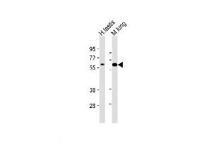 Western Blot at 1:2000 dilution Lane 1: human testis lysate Lane 2: mouse lung lysate Lysates/proteins at 20 ug per lane. (TGFBR2 antibody  (N-Term))
