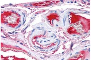 Human Small Intestine, Vessels (formalin-fixed, paraffin-embedded) stained with F12 antibody ABIN337368 at 5 ug/ml followed by biotinylated anti-goat IgG secondary antibody ABIN481715, alkaline phosphatase-streptavidin and chromogen. (F12 antibody)