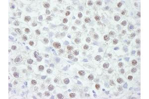Immunohistochemistry (IHC) image for anti-Checkpoint Kinase 2 (CHEK2) (AA 475-525) antibody (ABIN7448477)
