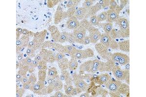 POMGNT1 antibody