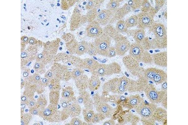 POMGNT1 antibody