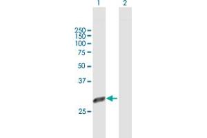 PSMD9 antibody  (AA 1-223)