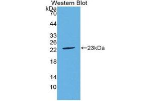 Western Blotting (WB) image for anti-Fibroblast Growth Factor 21 (FGF21) (AA 29-209) antibody (ABIN1867952) (FGF21 antibody  (AA 29-209))
