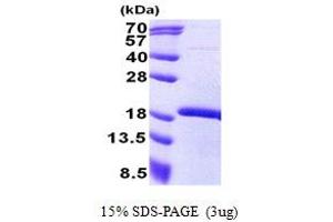 SDS-PAGE (SDS) image for Mesenchyme Homeobox 2 (MEOX2) (AA 188-304) protein (His tag) (ABIN5853070)