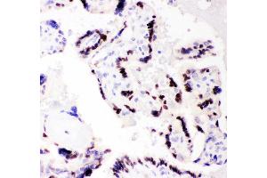 Anti- CEBP Beta Picoband antibody, IHC(P) IHC(P): Human Placenta Tissue (CEBPB antibody  (AA 1-200))