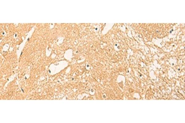 STK32C antibody