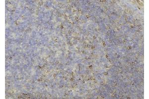 ABIN6273689 at 1/100 staining Human lymph node tissue by IHC-P. (KRT81 antibody  (C-Term))