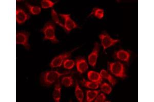 ABIN6267505 staining LOVO by IF/ICC.