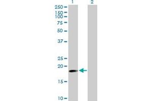 Western Blot analysis of TNFAIP8 expression in transfected 293T cell line by TNFAIP8 MaxPab polyclonal antibody. (TNFAIP8 antibody  (AA 1-190))