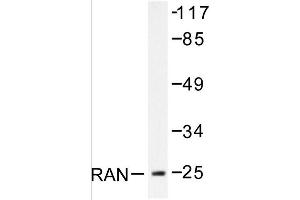 Image no. 1 for anti-RAN, Member RAS Oncogene Family (RAN) antibody (ABIN271799) (RAN antibody)